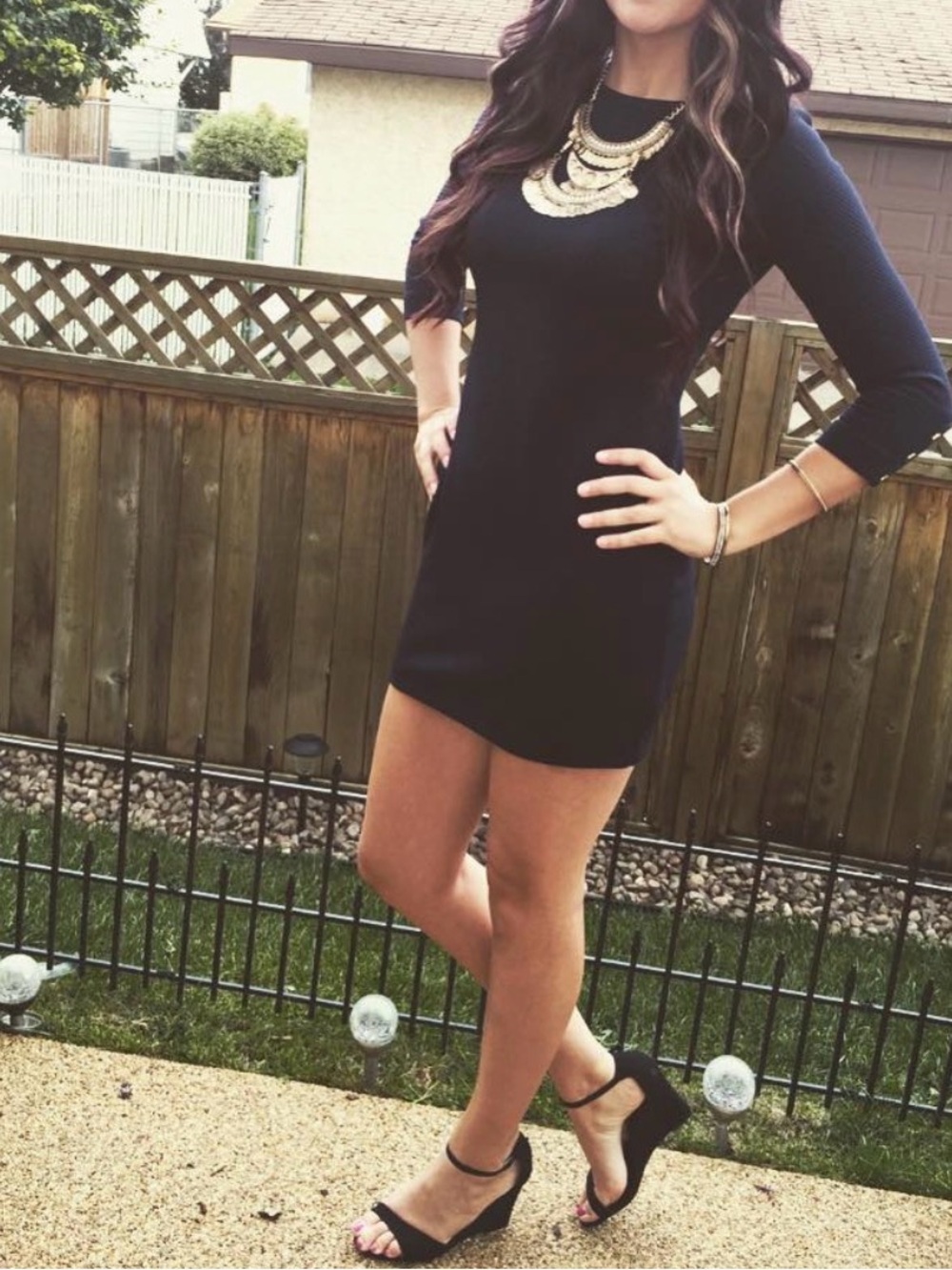 Dynamite Black Mini Dress with Gold Button Details